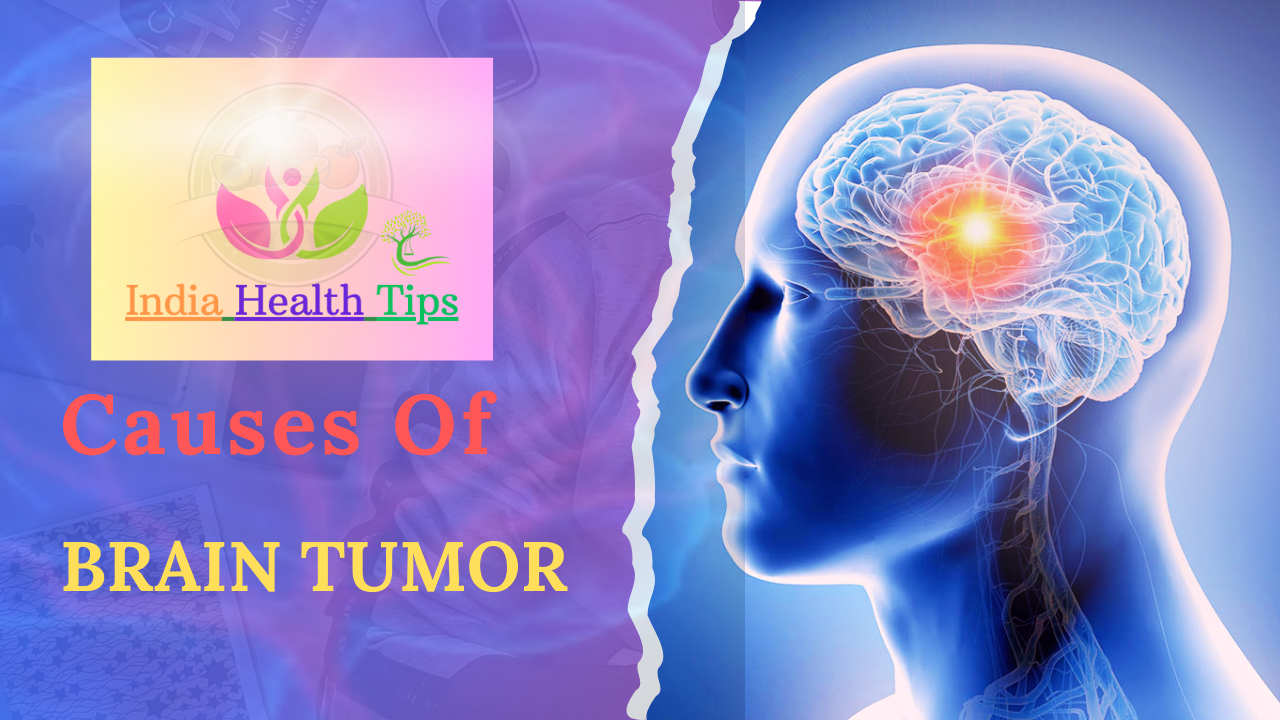 Causes Of Brain Tumor - బ్రెయిన్ ట్యూమర్ కారణాలు..