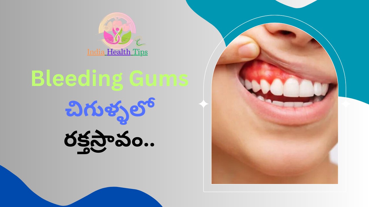 Bleeding Gums - చిగుళ్ళలో రక్తస్రావం..