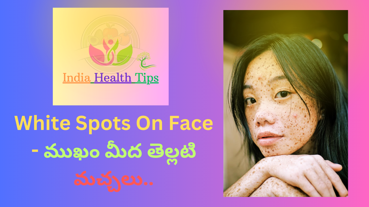 White Spots On Face - ముఖం మీద తెల్లటి మచ్చలు..