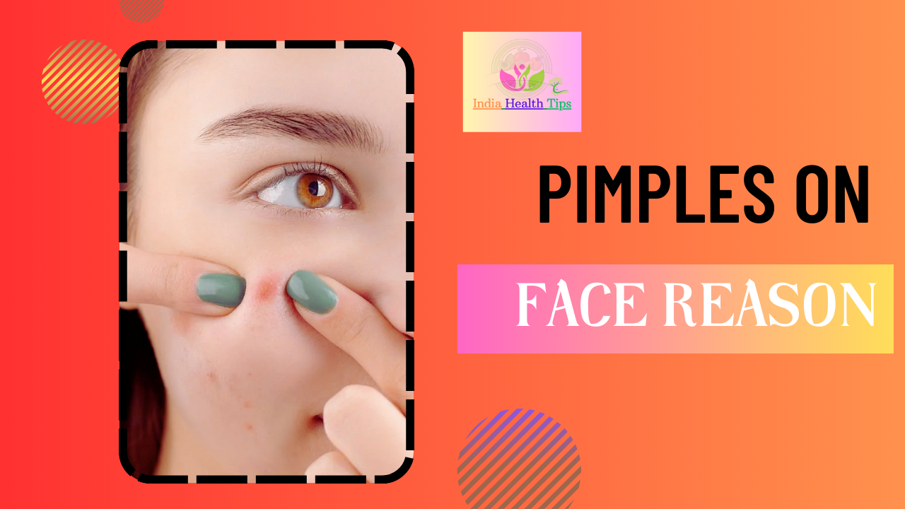 Pimples On Face Reason - ముఖం మీద మొటిమలు కారణం..