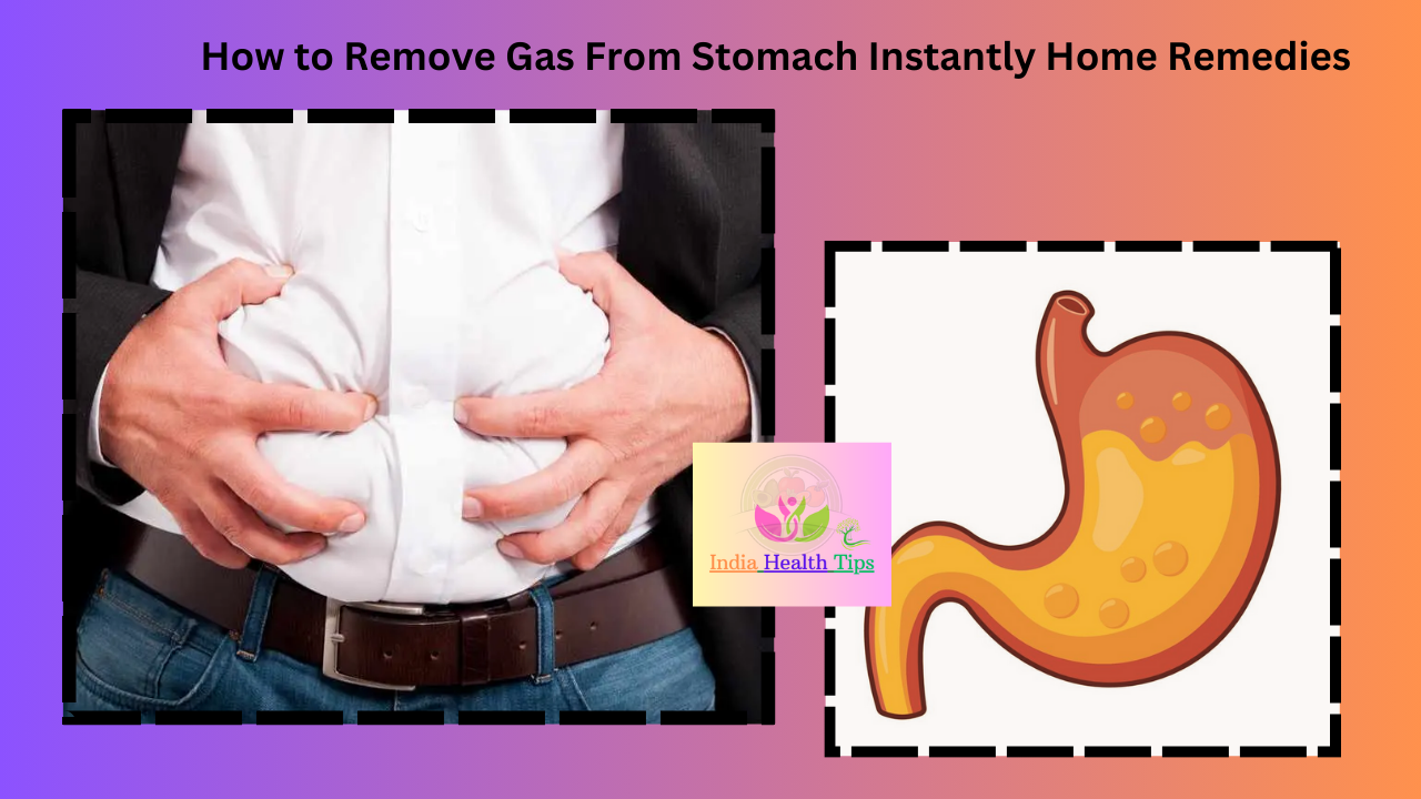 How to Remove Gas From Stomach Instantly Home Remedies - గ్యాస్ తొలగించడం ఎలా పొట్ట నుండి తక్షణం ఇంటి నివారణలు