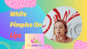 White Pimples On Lips - పెదవులపై తెల్లటి మొటిమలు..