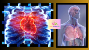 Cardiovascular Diseases - కార్డియోవాస్కులర్ వ్యాధులు...